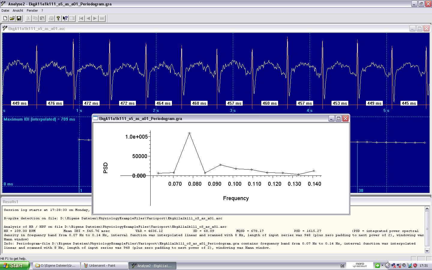 ECG analysis