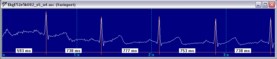 Varioport raw data